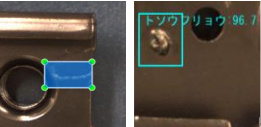 イースト菌感染症はどれくらいの期間続きますか?